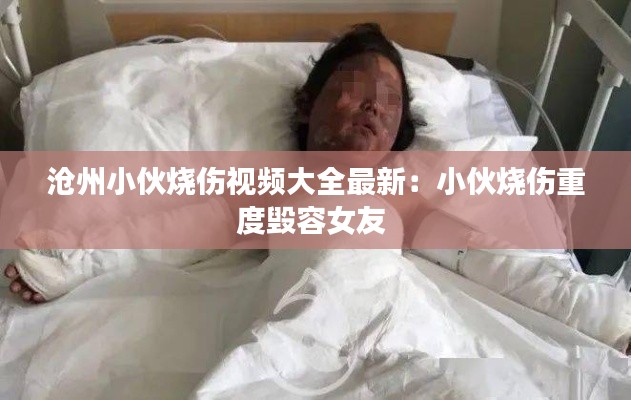 沧州小伙烧伤视频大全最新：小伙烧伤重度毁容女友 