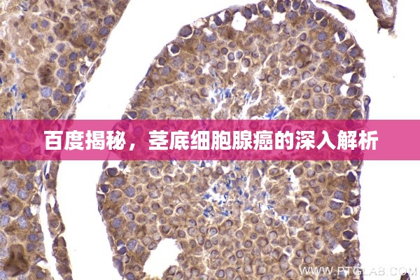 百度揭秘，茎底细胞腺癌的深入解析