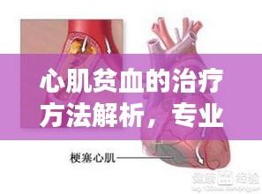 心肌贫血的治疗方法解析，专业解读，百度为你解答